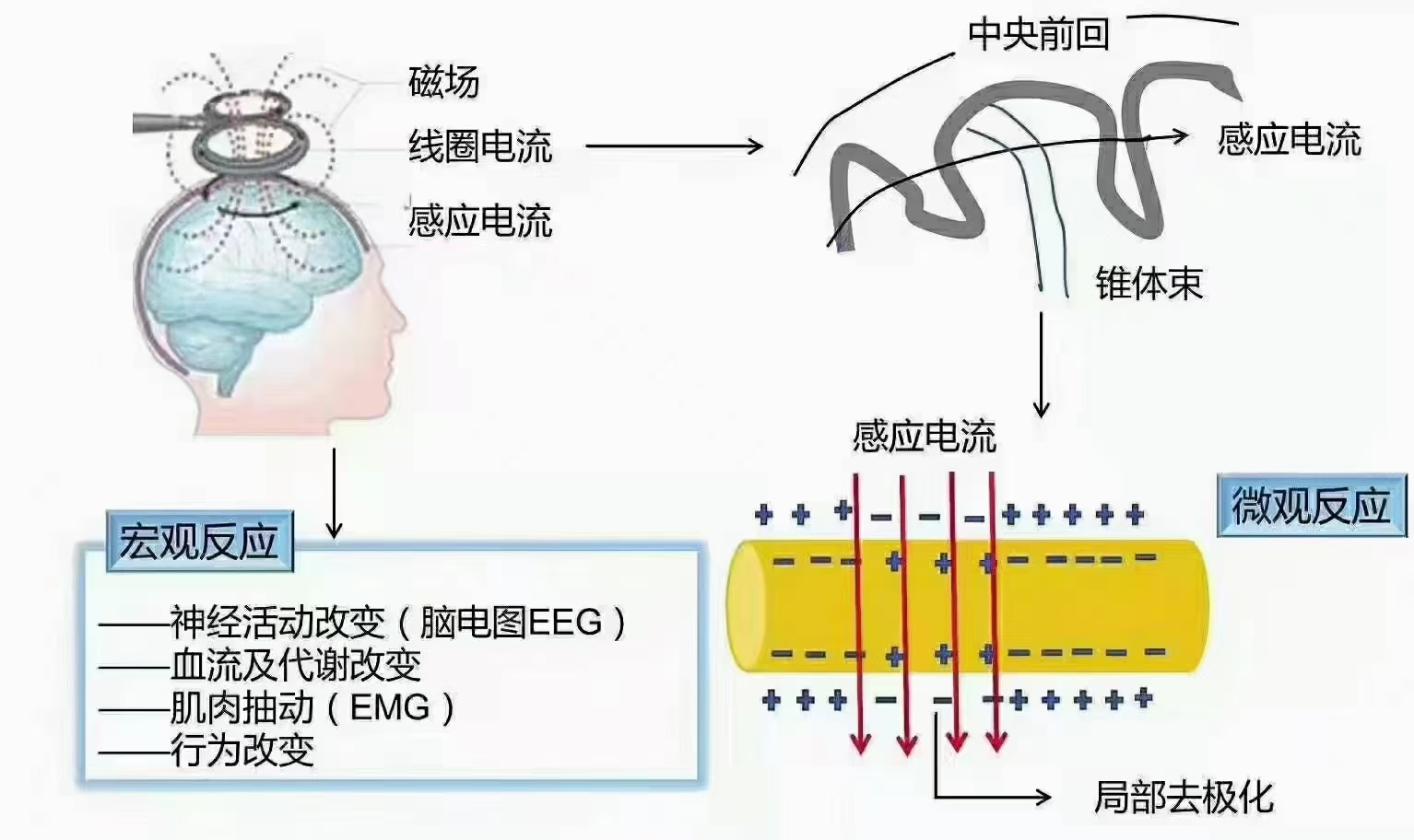 家用的rTMS经颅磁_有脑瘫常怎么做康复训练